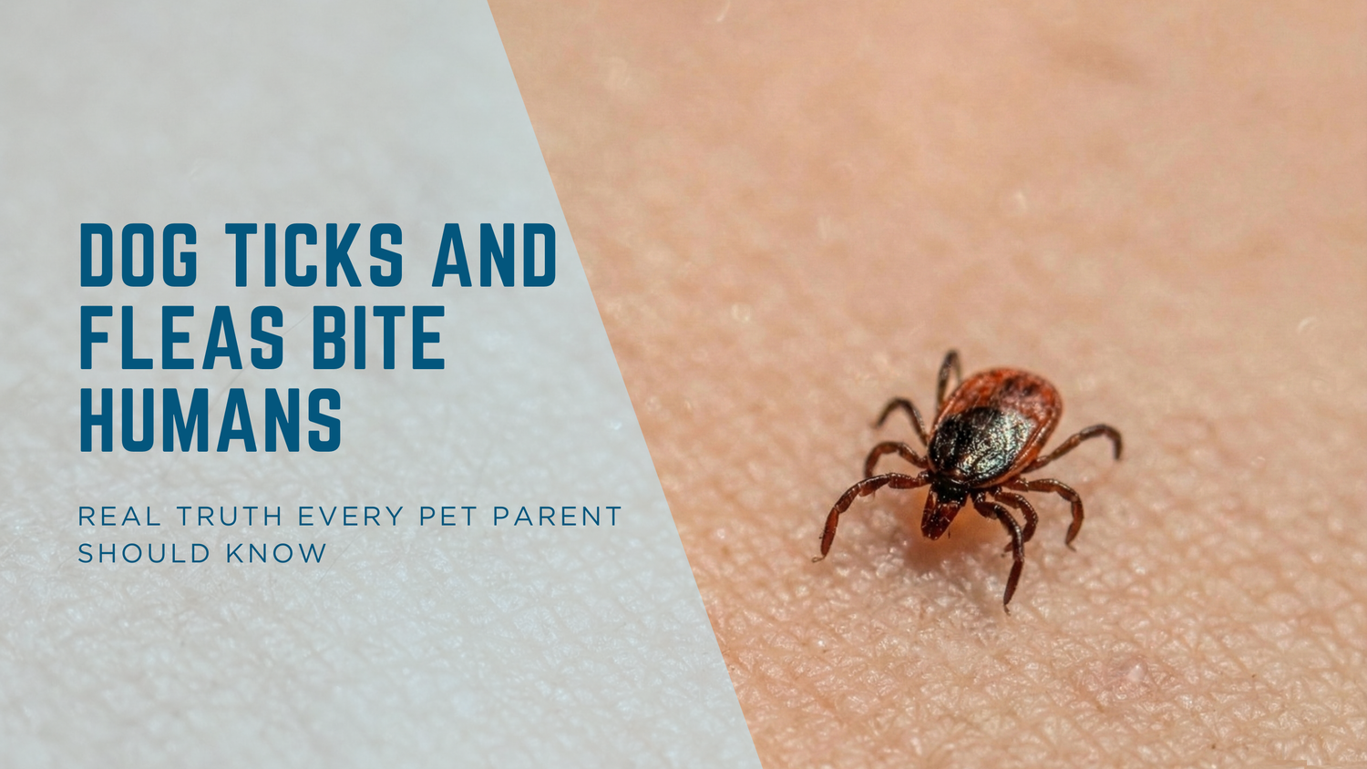 Do Dog Ticks and Fleas Bite Humans? Here’s the Real Truth Every Pet Parent Should Know